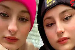 سارا و نیکا عمل زیبایی دارند؟! | خودشان چه گفتند؟! + عکس ها را مقایسه کنید