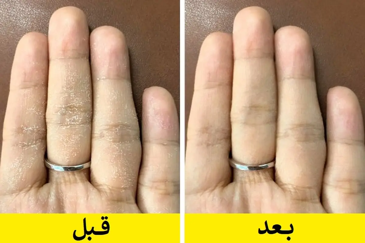 روش خانگی برای رفع خشکی دست ها