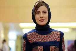 تغییر چهره باور نکردنی “سارا بهرامی” بعد از عمل زیبایی!