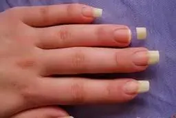 
مشکلات ناخن و شکنندگی آنها راچگونه برطرف کنیم؟
