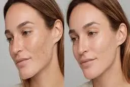 کلک‌های هزار پیج پزشکی زیبایی | دروغ در عکس‌های قبل و بعد +ویدئو