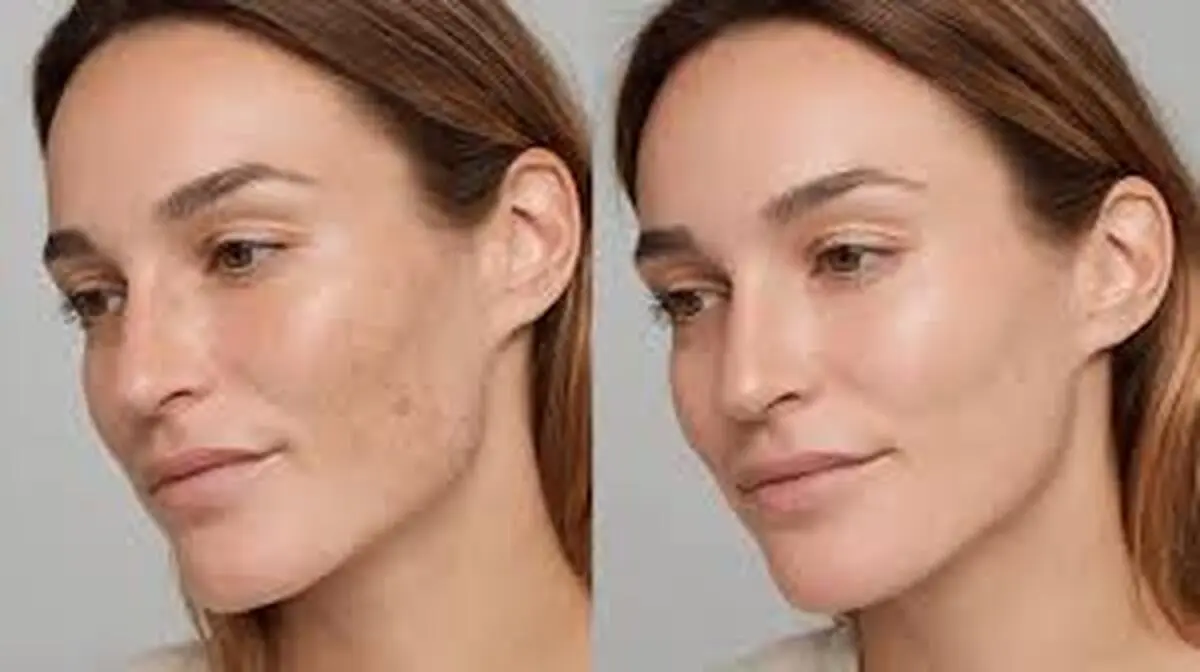 کلک‌های هزار پیج پزشکی زیبایی | دروغ در عکس‌های قبل و بعد +ویدئو