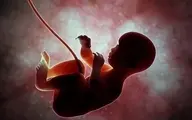 
 احکام فقهی سقط "جنین ناقص‌‌الخلقه‌ " 
