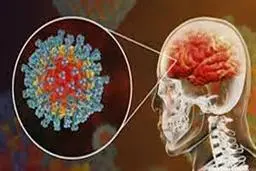  اختلال در هوشیاری و عفونت مغز از عواقب تاثیر کرونا بر سیستم عصبی است