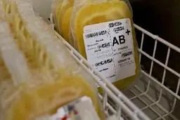 مسیر خودکفایی ایران در تهیه داروهای مشتق از پلاسما 