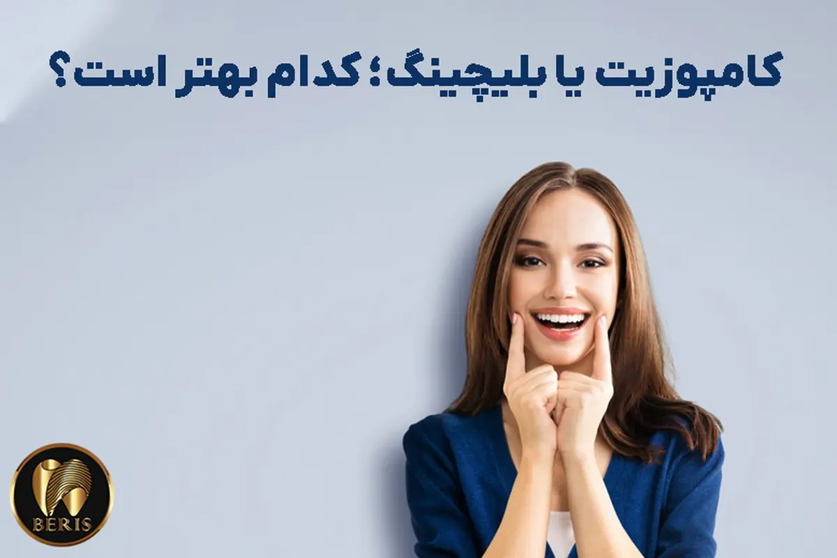 بلیچینیگ یا کامپوزیت دندان؟ کدام بهتر است؟