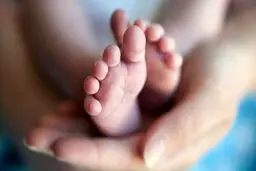 این نوزاد با دو بال به دنیا آمد | به دنیا آمدن نوزادی  عجیب الخلقه با دو بال فرشته