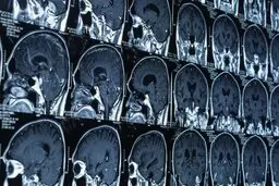  سخنرانی ۱۰سخنران برجسته درباره به روزترین موضوعات نقشه برداری مغز