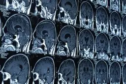  سخنرانی ۱۰سخنران برجسته درباره به روزترین موضوعات نقشه برداری مغز
