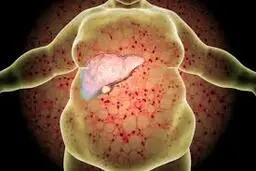 با خوردن این چند میوه کبد چرب را درمان کنید 