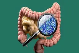 تاثیر رژیم غذایی پرچرب همراه با آنتی بیوتیک در بروز التهاب روده