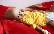 مرگ یک کودک یمنی در هر 5 دقیقه 