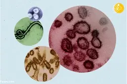 چرا سارس، مرس و ابولا، همچون کرونا جهان را به قرنطینه نکشاند؟! 