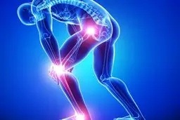 از کجا بفهمیم مبتلا به عارضه آرتروز شدیم؟ | نشانه‌های عارضه آرتروز در سنین پایین +ویدئو