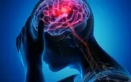   علائم سکته مغزی چیست| سکته مغزی چگونه  رخ میدهد ؟