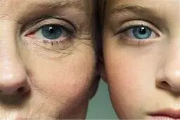 هر خوراکی ای چه مشکل پوستی ایجاد میکنه؟ + ویدیو 