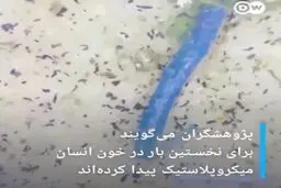 برای نخستین بار وجود میکروپلاستیک‌ها در خون انسان به اثبات رسید+ویدئو 