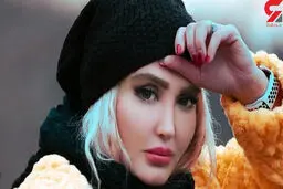 اعتیاد زهره فکورصبور به عمل زیبایی !