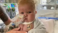 نوزاد آمریکایی با اولین پیوند قلب و تیموس در تاریخ پزشکی ماندگار شد