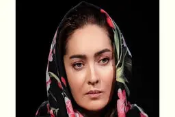 نیکی کریمی بعد از عمل های زیبایی را ببینید | تغییرات عجیب خانم بازیگر + تصویر