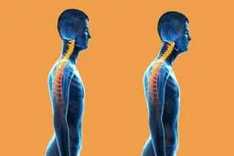 کارمندان حواسشان باشد |  تمام کارمندان عارضه سر به جلو را دارند! + ویدئو 