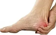 دلایل درد در ناحیه پاشنه چپ پا و راه‌های درمان 