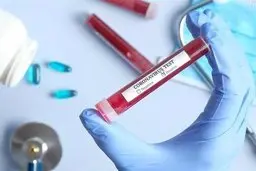 سریع ترین روش تشخیص کووید 19 ابداع شد