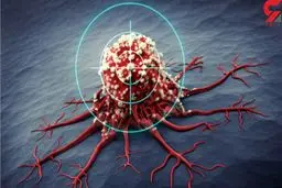 5 اقدام ساده برای کاهش 30 درصدی احتمال ابتلا به انواع سرطان
