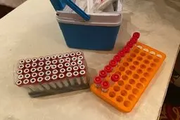 مسافران مشکوک به کرونا در مرزها افزایش یافت