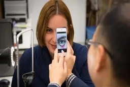 
 با دوربین گوشی‌های هوشمند میتوان کم خونی را تشخیص داد
