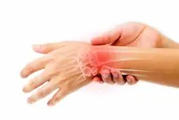 کیست گانگلیون چیست و چه راهکار درمانی‌ای دارد؟ | اگه روی مچ دستت دردناک شده ببین +ویدئو