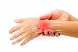 کیست گانگلیون چیست و چه راهکار درمانی‌ای دارد؟ | اگه روی مچ دستت دردناک شده ببین +ویدئو