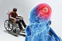 هوش مصنوعی یک بیماری جعلی متولد کرد!