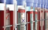 برای تشخیص محرمانه و رایگان "ایدز" به کجا باید مراجعه کرد؟
