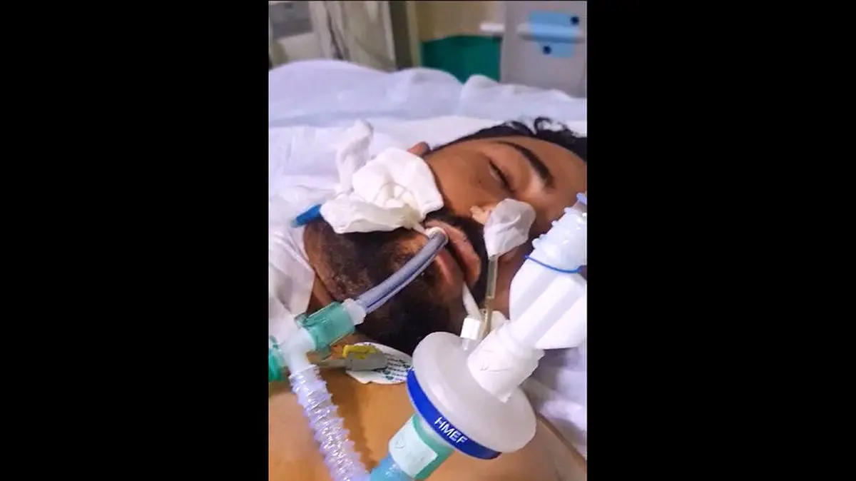 پیوند زدن سر قطع شده! | شاهکار جراحان ایرانی برای بار چهارم در جهان +فیلم