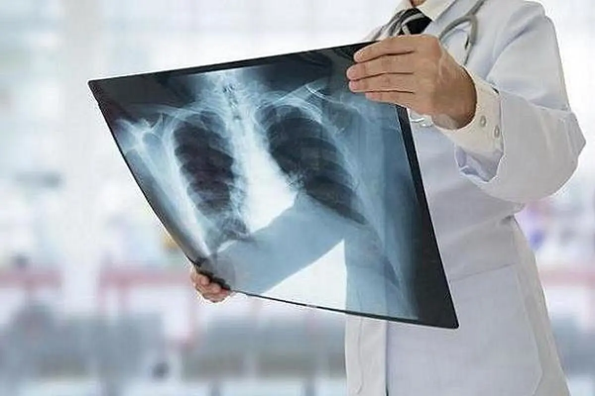 هشدار درباره برخی از تغییرات کوچک در بدن