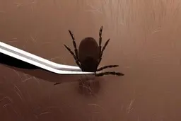  نحوه ی صحیح جدا کردن کنه از پوست ؟