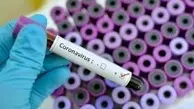 افزایش آزمایشگاه‌های تشخیص کرونا به ۲۲ آزمایشگاه در کشور تا هفته آینده
