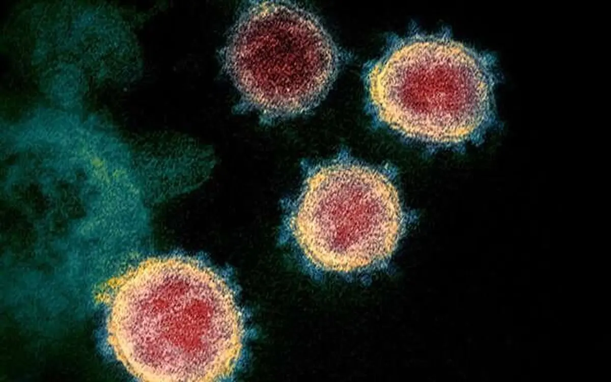  کاهش تعداد بیماران بدحال کرونا در شهر تهران 
