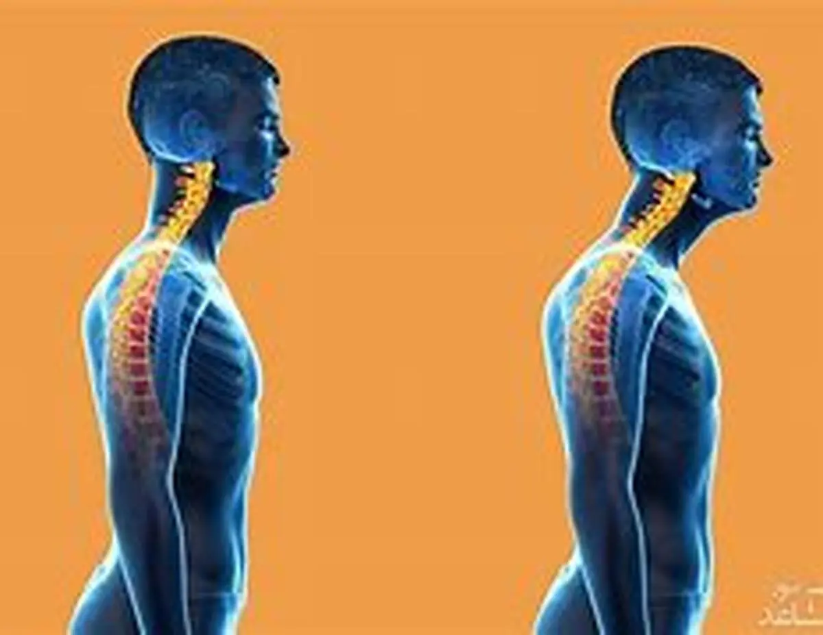 اگر قوز می‌کنید این اندام حیاتی شما در خطر است | چرا نباید پشتمان را خم کنیم؟ +ویدئو