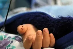 حادثه دلخراش برای کودک 5 ساله | پسر 5 ساله دچار برق گرفتگی شد + تصویر