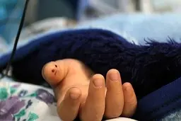 حادثه دلخراش برای کودک 5 ساله | پسر 5 ساله دچار برق گرفتگی شد + تصویر