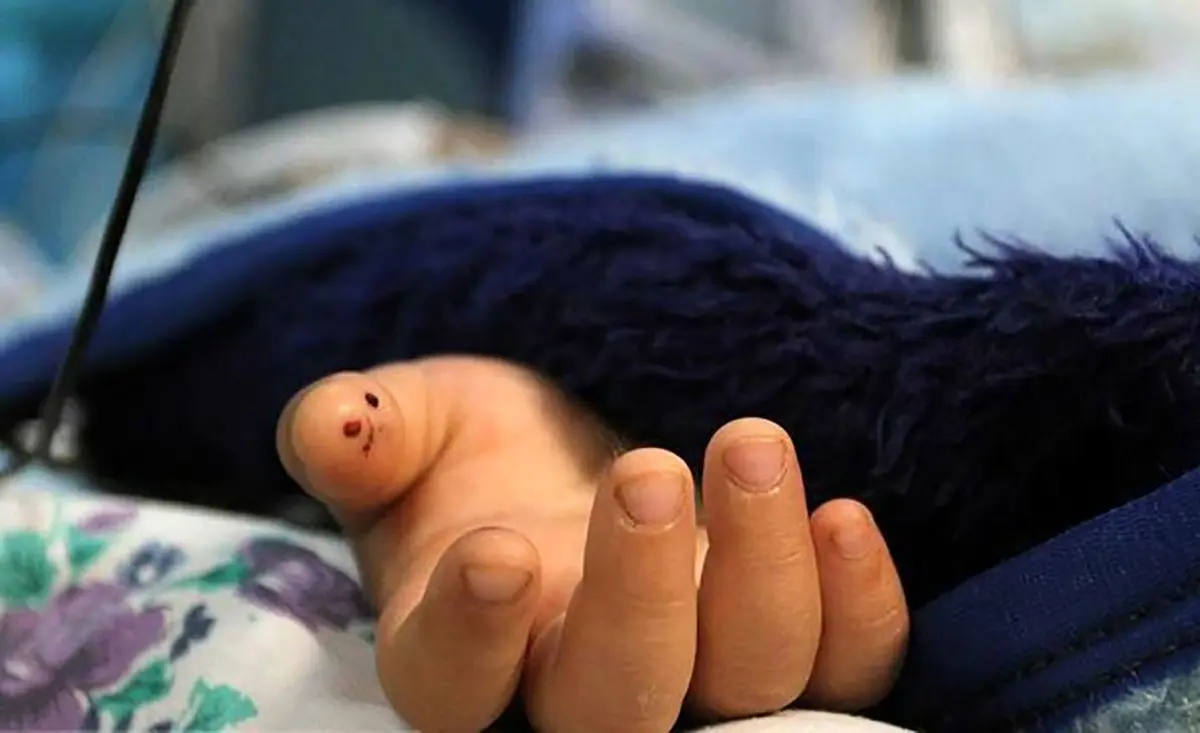 حادثه دلخراش برای کودک 5 ساله | پسر 5 ساله دچار برق گرفتگی شد + تصویر