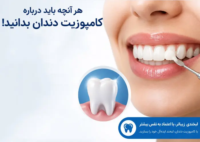 سوالات متداول کامپوزیت دندان