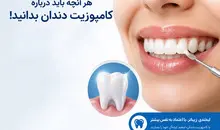 سوالات متداول کامپوزیت دندان
