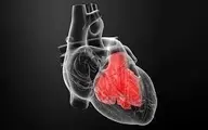 آیا التهاب عضلات قلب از عارضه جانبی واکسن کرونا است؟
