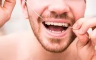 از نخ دندان قبل از مسواک زدن باید استفاده کرد یا بعد از آن؟