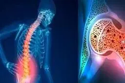 اصلی ترین مواد غذایی استخوان ساز کدامند؟