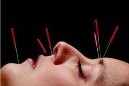 استفاده از طب سوزنی و مکمل در درمان کرونا صحت دارد؟ 