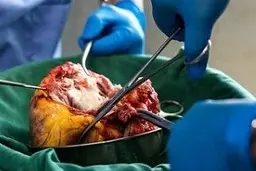 افراد زنده هم امکان اهدای عضو دارند؟